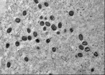 Mpox ainda é problema de saúde pública, dizem especialistas da Fiocruz
